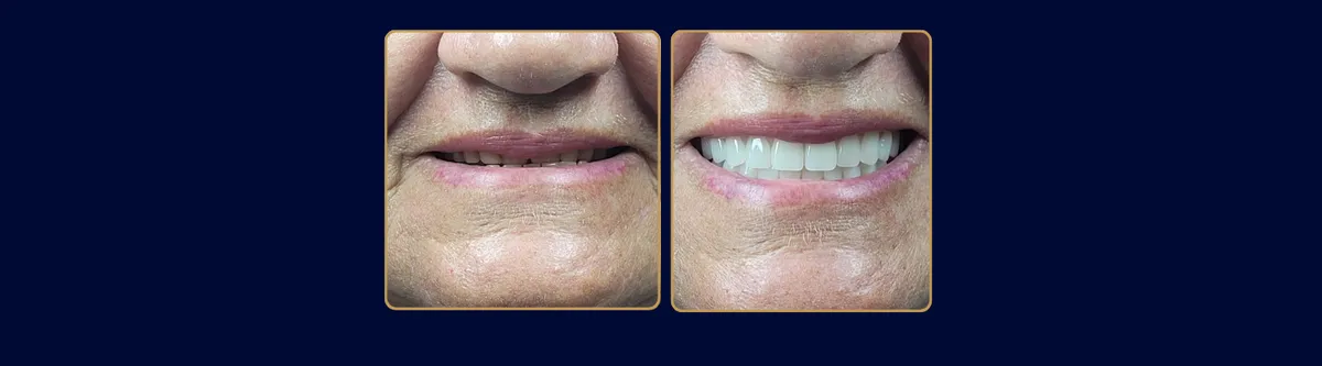 Tatiana Bisetto Casarin - Odontologia em Itatiba em Itatiba, SP