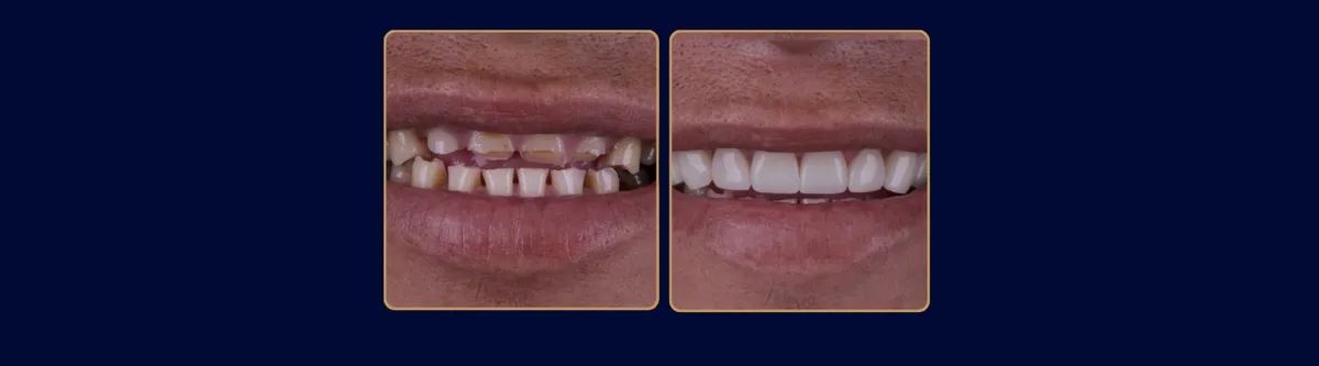 Tatiana Bisetto Casarin - Odontologia em Itatiba em Itatiba, SP