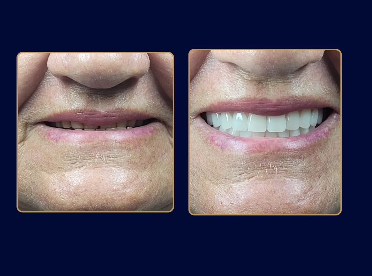 Tatiana Bisetto Casarin - Odontologia em Itatiba em Itatiba, SP